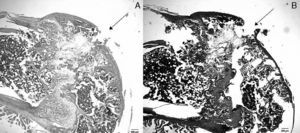 Histological analysis of the OCL produced. Shown as a sagittal section of the trochlear region of an animal sacrificed after 7 days, representing the full sample. (A) Staining with hematoxylin–eosin showing the solution of contiguity of the joint surface. (B) Staining with safranin-O; it is possible to identify the OCL and depth reaching the physis (*).