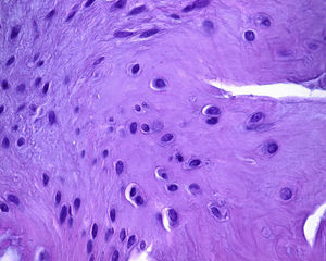 Hematoxylin and eosin (400×) staining of the biopsy taken from the central part of the implant showing the growth of the fibrocartilage.