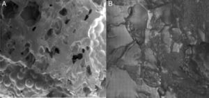 Rugosity of the surface (scanning electron microscopy) of PMMA with 20% HA (A) and of PMMA alone (B).