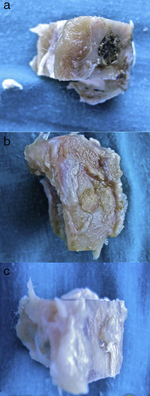 Macroscopic study. (a) Defect filled with calcium phosphate. Control group. (b) Defect filled with calcium phosphate+PRP. PRP group. (c) Appearance of the critical defect of the GH group. In these cases we found the Kirschner wire useful for locating the site.