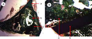 Control group histology. (a) Rabbit control group 15 increases. Transverse cut Masson's trichrome stain. General appearance. The bone tissue is distinguished from the cortex (a), the calcium phosphate cement which fills the medullary channel (b) and the cortical critical defect marked with Kirschner wire (c). (b) Rabbit control group 30 increases. Masson's trichrome stain. Kirschner wire used as a marker (a), surrounded by biomaterial (b) in the site of the critical defect. No bone tissue formation is observed.