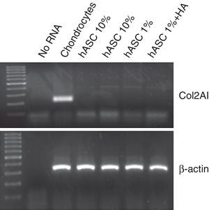 mRNA expression for type 2 collagen by RT-PCR. The specific fragment for type 2 collagen (204pb) is only seen in chondrocytes (positive control), whereas all the cell samples contain the ß-actin fragment (309pb).