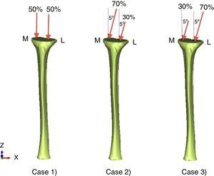 Loads and surrounding conditions. M, medial; L, lateral.