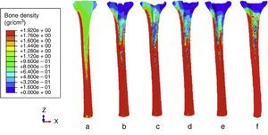 Bone density distribution (g/cm3) 300 days after incorporating the prosthesis. (a) Before the implantation. (b) Offset stem with without supplement. (c) Straight stem. (d) Offset stem with supplement. (e) Sleeves with stem. (f) Sleeves without stem. (See different prostheses in Fig. 1.)
