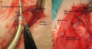 Creation of the tendon injury: (a) tendon marked with Prolene® and proximal section to its insertion in the troquiter; (b) retraction of the tendon in the chronic injury.