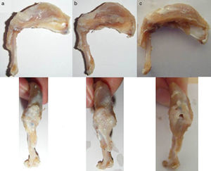 Macroscopic view of specimens: (a) good macroscopic appearance; (b) calcification and muscular atrophy; (c) re-rupture of tendon.
