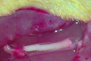 Intraoperative image of the implantation of the acellular nerve prosthesis with an ¿-CPL tube (G2).