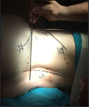 Position of the patient.