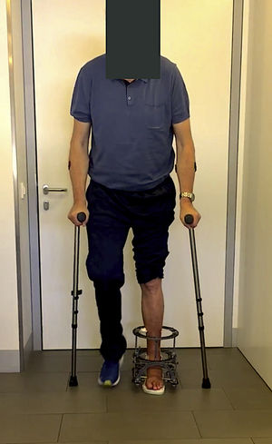Support in immediate postoperative period.