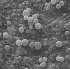 Staphylococcus aureus on hydroxyapatite surface, with scanning electron microscopy.