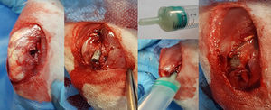 Surgical approach, insertion of the contaminated rod and sealing the defect with bone cement.