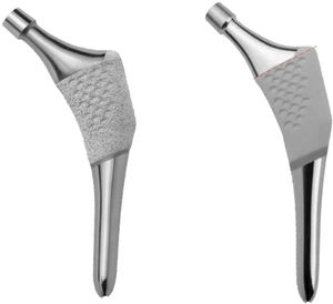 Image of ANATO stem (left) and its predecessor, the ABG-II stem (right). The difference in the porous hydroxyapatite coating at proximal level is visible.