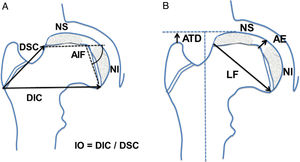 Diagram showing the measurements taken in anteroposterior hip projection. (a) AIF: intraphyseal angle; DIC: inferior distance of the neck; DSC: superior distance of the neck; IO: ovalisation index; NI: inferior re-ossification nucleus; NS: superior re-ossification epiphyseal nucleus. (b) AE: epiphyseal height in the centre; ATD: article-trochanter distance; LF: physeal length or cephalic diameter; NI: inferior re-ossification nucleus; NS: superior epiphyseal re-ossification nucleus.