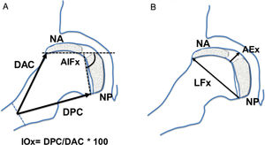 Diagram showing the measurements taken in lateral, frog leg or Löwenstein hip projection. (a) AIFx: axial intraphyseal angle; DAC: anterior distance of the neck; DPC: posterior distance of the neck; IOx: axial ovalisation index; NA: anterior re-ossification epiphyseal nucleus; NP: posterior re-ossification nucleus. (b) AEx: axial epiphyseal height in the centre; LFx: physeal length or axial cephalic diameter; NA: anterior re-ossification epiphyseal nucleus; NP: posterior re-ossification nucleus.