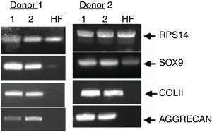 Genetic study being the expression of specific chondrocyte genes, such as the sox9 gene.