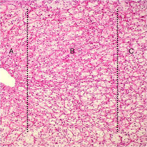 Acercamiento: las líneas punteadas distinguen las 3 capas de la corteza suprarrenal (A: zona glomerular, B: zona fascicular, C: zona reticular).