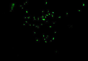 Inmunofluorescencia con tinción de auramina-rodamina positivo, en la cual se confirma la presencia de los bacilos.