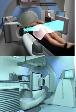 Arco de terapia volumétrica modulada mostrando rotación del cabezal en 360°. Tiempo de radiación 120seg.