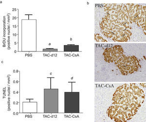 Proliferation (a) and apoptosis (b) of beta cells. The mean is represented±SD. (a) a: TAC-d12 vs PBS p=0.009; b: TAC-CsA vs PBS p=0.001 and vs TAC-d12 p=0.003. (b) c: TAC-d12 v PBS p=0.172. d: TAC-CsA vs PBS p=0.311 and vs TAC-d12 p=0.824.