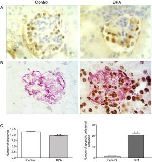BPA produces podocytopoenia in mice. (A) Immunohistochemistry for WT-1. In mice treated with BPA the number of podocytes (brown nuclei) was lower than in controls. 300×. (B) TUNEL assay (black nuclei) combined with immunohistochemistry for podocin (grey expansions). The renal corpuscles of those mice treated with BPA showed a higher number of apoptotic podocytes than controls. 300×. (C) Left, graph representing the statistical analysis of the number of podocytes. Right, histogram representing the number of apoptotic cells in mice treated with BPA and in controls. ***P<.001 using ANOVA for analysis of variance.