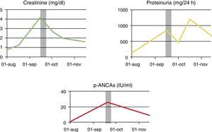 Evolution of creatinine, proteinuria and p-ANCA figures after starting treatment with corticosteroids and cyclophosphamide. The grey band represents the period of admission in the nephrology department.