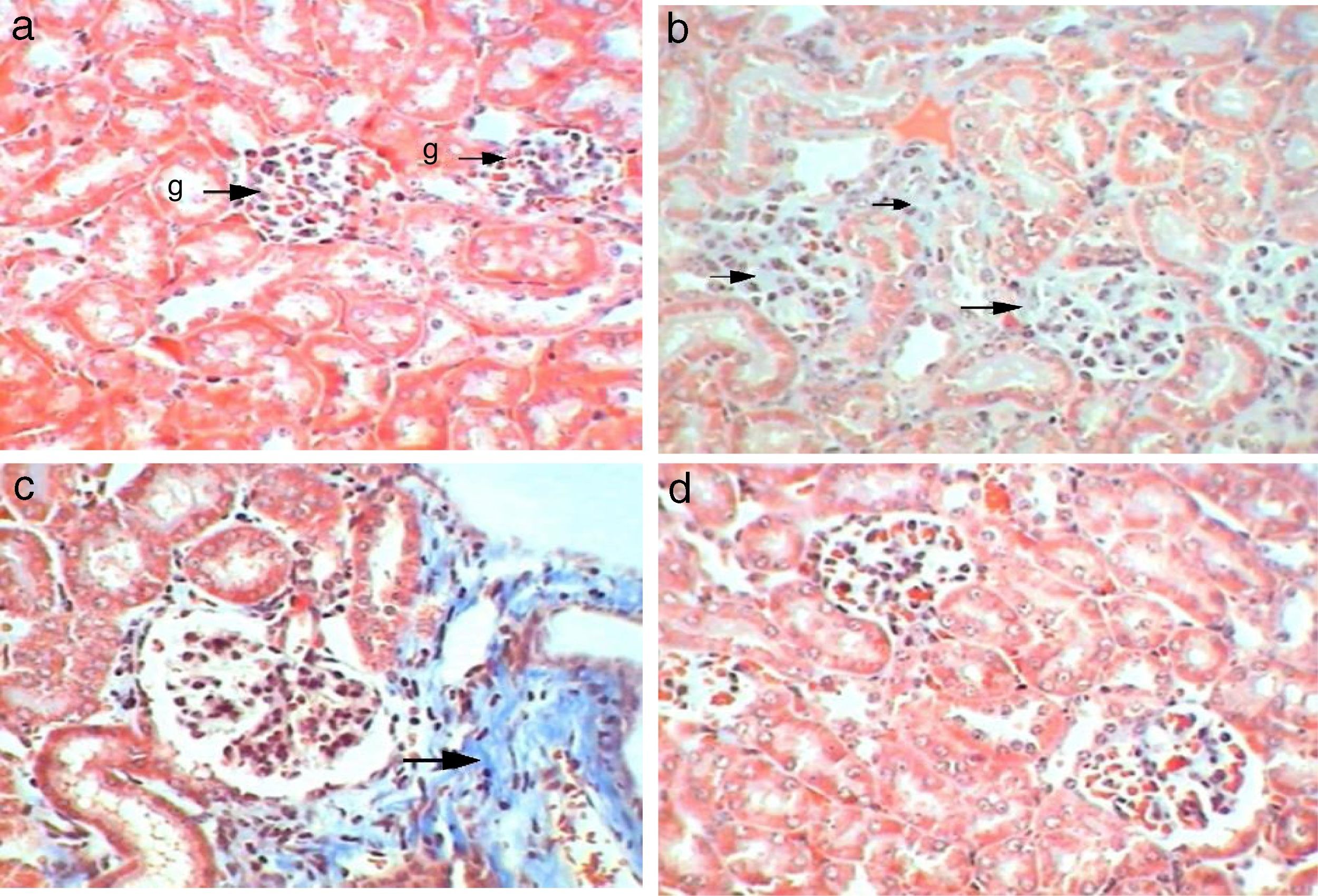 Reno-protective effects of propolis on gentamicin-induced acute renal ...