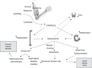 Possible mechanisms involved in the pathophysiology of kidney injury associated with hypercalcemia and injectable vitamins A, D and E supplements.