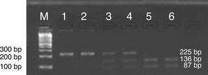 2% agarose gel electrophoresis stained with ethidium bromide showing the PCR-RFLP analysis of the ICAM-1. Lanes M: DNA marker. Lanes 1, 2: AA allelic polymorphism; Lane 3, 4: AG allelic polymorphism; Lane 5, 6: GG allelic polymorphism.