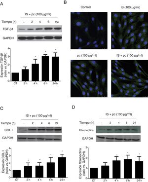 High doses of uremic toxins induce the expression of the profibrotic cytokine TGF-β1 and extracellular matrix proteins in vascular smooth muscle cells. Human aortic smooth muscle cells were incubated with medium supplemented with 2.5% human serum for 24h. Subsequently they were treated for 2, 4, 6 or 24h (A, C and D) or 24h (B) with uremic toxins: indoxil-sulfate (IS 100μg/ml), para-cresol (pc 100μg/ml) or a mixture of both (IS+1pc 100μg/ml). Representative Western blots of TGF-β1 (A), collagen I (COL I, C) and fibronectin (D) are shwon. The levels of GAPDH were determined as their respective endogenous controls. The bars represent the values of the densitometric analysis of the normalized blots against the endogenous control. The expression of TGF-β1 was analyzed by immunofluorescence (B). Representative images of the photographs obtained by confocal microscopy (100×) are shown. The values are represented as the mean±SEM. * p<0.05 vs. Control (CT, untreated cells).