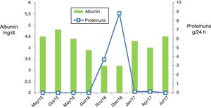 Analytical progression. Shows a reduction in serum albumin levels with onset of proteinuria and the subsequent recovery of both parameters.