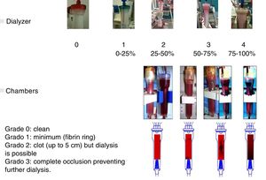 Scores of coagulation of cameras and dialyzer.