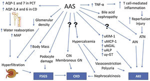 Pathophysiology of kidney injury due to AAS use. AAS, anabolic androgenic steroids. Question marks indicate mechanisms that are not understood. AQP, aquaporin. PCT, proximal convoluted tubule. CD, collecting duct. MAP, mean arterial pressure. FSGS, focal segmental glomerulosclerosis. TNF-α, tumor necrosis factor α. ATN, acute tubular necrosis. AIN, acute interstitial nephritis. CIN, chronic interstitial nephritis. GN, glomerulonephropathy. uKIM-1, urinary kidney injury molecule 1. uMCP-1, urinary monocyte chemoattractant protein 1. uNGAL, urinary neutrophil gelatinase-associated lipocalin. uALP, urinary alkaline phosphatase. uγ-GT, urinary γ-glutamil transpeptidase. CKD, chronic kidney disease. AKI, acute kidney injury.