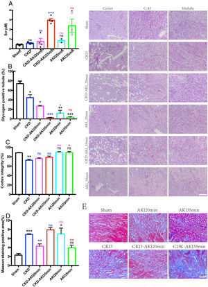 Serum creatinine and renal histopathological changes after acute kidney injury based on CKD. A: Serum creatinine levels can reflect acute kidney injury in both normal and CKD kidneys. Serum creatinine dramatically increased in severe acute kidney injured CKD (sAonC) mice, but not in moderate acute kidney injured CKD (mAonC) mice. B–D: CKD kidneys exhibited more severe morphological injury in the cortex region, but with fewer injuries in corticomedullary junction. Acute injury caused the severe injury in corticomedullary junction in both AKI and AonC kidneys Scale bar=100μm. E: Masson