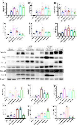 Variation of AKI biomarkers’ expression in AonC and AKI kidneys. A–F: mRNA levels of KIM-1, NGAL, IGFBP7, TIMP-2, RHBDL2 and SDC-1 in AonC and CKD kidneys. G: protein levels of KIM-1, NGAL, IGFBP7, TIMP-2, RHBDL2 and SDC-1 in AonC and CKD kidneys. H–M: Quantification of KIM-1, NGAL, IGFBP7, TIMP-2, RHBDL2 and SDC-1 protein expression in AonC and CKD kidneys. The data are shown as the mean±SEM, *, p<0.05; **, p<0.01; ***; n=3–4. * Color means compared with the corresponding column.