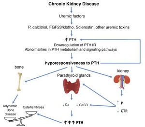 Potential time sequence and consequences of hyporesponsiveness to PTH in CKD. With the development of chronic kidney disease (ie decreased glomerular filtration), factors related to the loss of kidney function (for example the classic phosphorus overload and/or decreased calcitriol) together with factors (known or yet unknown) associated with "uremia" itself, would lead to an increase in PTH. These, together with alterations in PTH metabolism, interferences in its signaling pathways and/or downregulation of its receptors, would condition additional increases in PTH due to its abnormally diminished response. By different mechanisms, the less calcemic response to the action of PTH, the more hormone is necessary to restore calcium levels to normal (greater synthesis and secretion of PTH, as well as greater need for cell proliferation). Likewise, new vicious cycles would be created at the kidney level and imbalances in the bone depending on whether anabolic or inhibitory elements prevail. Osteitis fibrosa is the bone expression of secondary hyperparathyroidism (high turnover bone disease) and adynamic bone disease is the result of low bone turnover. CTR: calcitriol; FGF-23: Fibroblast Growth Factor 23; P: phosphorus; PTH1R: parathyroid hormone receptor (PTH); CaSR: calcium sensing receptor (adapted from Bover et al.148).
