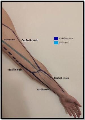 Venous anatomy of the upper limb.