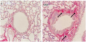 Representative photomicrographs of lung tissue stained with Picro-Sirius red at 400× magnification. C: control group; CKD: chronic kidney disease group.