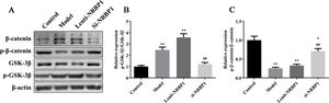 Effect of NRBP1 knockdown or overexpression on the Wnt/β-catenin signaling pathway in HK-2 cells. A, Western blot was used to analyze the expression levels of β-catenin, p-β-catenin, GSK3β and p-GSK3β in stably si-NRBP1-transfected or NRBP-1 overexpression HK-2 cells. B–C, Semi-quantification of the expression levels of proteins in parts A. (χ¯±s,n=3), *P<0.05, **P<0.01 vs. Control group, #P<0.05, ##P<0.01 vs. Model group.