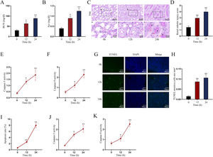 Establishment of LPS-induced AKI mice model and mouse renal tubular epithelial cell model. For LPS-induced AKI mice model, mice were intraperitoneally injected with LPS (10mg/kg) for 0, 12, and 24h. (A, B) The BUN and SCr levels were examined via qRT-PCR analysis (one-way ANOVA, Tukey). (C) The images of pathological section of LPS-treated mouse kidney tissue samples stained by PAS were shown (scale bar: upper: 20μm, lower: 5μm). Red arrows indicate swelling of renal tubular epithelial cells; black arrows indicate tubular lumen shrinkage; white arrows indicate vacuolar deformation. (D) The LPS-treated mice model