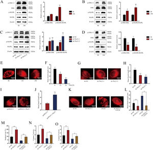 Tbx21 modulates mitochondrial fission and cell apoptosis through MAPK/ERK signaling pathway. (A, B) The protein level of p-ERK1/2 was increased in renal tubular cell of LPS-induced AKI mice model (10mg/kg; 24h) and LPS-induced AKI mouse renal tubular epithelial cell model (5μg/mL; 24h), individually (Student