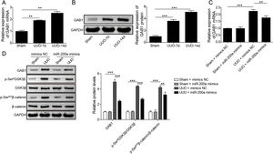 The regulation of miR-200a to GAB1 expression and activation of Wnt/β-catenin signaling. (A, B) The relative levels of GAB1 mRNA and protein in renal tissues was analyzed utilizing qRT-PCR and Western blot after the 7 days and 14 days of UUO surgery, respectively. After that, (C) the relative expression level of GAB1 mRNA in renal tissues of the rats, which injected with miR-200a mimics- or mimics negative control-expressed lentivirus, was determined at the 14 days post-UUO. (D) After the 14 days of UUO surgery, the relative expression levels of GAB1, GSK3β, and β-catenin proteins, and the phosphorylation of GSK3β and β-catenin in renal tissues were analyzed through Western blot.