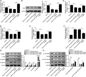 The regulation mechanism of miR-200a to TGF-β1-induced EMT and ECM deposition in HK-2 cells. TGF-β1-induced HK-2 cells were co-transfected miR-200a mimics with or without GAB1 overexpression vector. At 48h after transfection, (A) GAB1 gene expression was analyzed utilizing qRT-PCR. (B) Western blot was accomplished to ensure the expression level of GAB1 protein. (C–F) qRT-PCR was implemented to ensure the expression levels of Collagen I, N-cadherin, α-SMA, and E-cadherin genes in the cells. (G) The ECM-related proteins, Collagen and α-SMA, and the EMT-related markers, N-cadherin and E-cadherin, expression were confirmed utilizing Western blot. (H) The activation of Wnt/β-catenin signaling pathway was analyzed through examining the phosphorylation levels of GSK3β and β-catenin by Western blot.