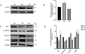 Effect of HG on ACSL1 protein levels and EMT-related proteins. (A) WB analysis demonstrated the expression levels of ACSL1 in HK-2 cells under normal glucose (NG), high glucose (HG) or mannitol (MA) treatment for 72h. (B) Quantitation of the arbitrary ratios of ACSL1 to GAPDH. (C) WB analysis demonstrated the expression levels of EMT-related proteins in HK-2 cells under normal glucose (NG), high glucose (HG) or mannitol (MA) conditions for 72h. (D) Quantitation of the arbitrary ratios of EMT-related proteins to GAPDH. Data information: all values are shown as the means±SEMs of at least three independent experiments. *P<0.05; **P<0.01, mean HG compared with NG.