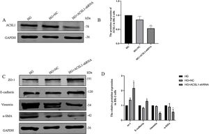 Effects of ACSL1 knockdown on renal fibrosis and EMT in HK-2 cells. (A) WB analysis demonstrated the expression levels of ACSL1 in HK-2 cells. (B) Quantitation of the arbitrary ratios of ACSL1 to GAPDH. (C) WB analysis demonstrated the expression levels of EMT-related proteins in HK-2 cells. (D) Quantitation of the arbitrary ratios of EMT-related proteins to GAPDH. HG: cells treated with 60mmol/L glucose; HG+NC: cells treated with HG and transfected with NC lentivirus; and HG+ACSL1-shRNA: cells treated with HG and transfected with ACSL1-shRNA lentivirus. Data information: all values are shown as the means±SEMs of at least three independent experiments. *P<0.05, **P<0.01, mean HG+ACSL1-shRNA compared with HG.