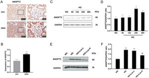 HG up-regulated ANGPT2 expression and losartan inhibited this process. (A) Representative immunohistochemical (IHC) staining of ANGPT2 in kidney. (B) Statistical data of IHC staining of ANGPT2 (n≥5). **P<0.01 vs. Control. (C) Representative western blot of ANGPT2; (D) Densitometric analysis of ANGPT2 western blot signals (n≥3). *P<0.05 vs. NG. (E) Western blot of ANGPT2 of hrGECs incubated with NG, HG, HG+Los-L, HG+ Los-H. (F) Densitometric analysis of western blot signals of ANGPT2 (n≥3). **P<0.01 vs. NG group, ##P<0.01 vs. HG group. Data are presented as means±SEM.