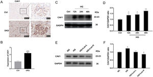 HG up-regulated CAV1 expression and losartan inhibited this process. (A) Representative immunohistochemical (IHC) staining of CAV1 in kidney. (B) Statistical data of IHC staining of CAV1 (n≥5). ***P<0.001 vs. Control. (C) Representative western blot of CAV1; (D) Densitometric analysis of CAV1 western blot signals (n≥3). *P<0.05 vs. NG, **P<0.01 vs. NG. (E) Western blot of ANGPT2 of hrGECs incubated with NG, HG, HG+Los-L, HG+ Los-H. (F) Densitometric analysis of western blot signals of ANGPT2 (n≥3). *P<0.05 vs. NG group, #P<0.05 vs. HG group. Data are presented as means±SEM.