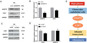 Regulation between ANGPT2 and CAV1 in hrGECs. (A) Western blot of ANGPT2 and CAV1 after transfection with shANGPT2 in HG condition. (B) Densitometric analysis of western blot signals of ANGPT2 and CAV1 (n≥3). **P<0.01 vs. scra. (C) Western blot of ANGPT2 and CAV1 after transfection with si-CAV1 in HG condition. (D) Densitometric analysis of western blot signals of ANGPT2 and CAV1 (n≥3). *P<0.05 vs. si-NC. (E) Summary chart of relationship between ANGPT2 and CAV1 in GECs during HG exposure. Data are presented as means±SEM.