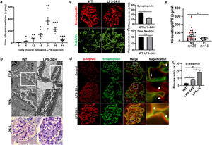 LPS replicates some key features of human MCD. (a) LPS causes transient albuminuria reaching a peak at 24h. N=4–6 per group. * p=0.004; ** p=0.002; *** p=0.009, compared to control group (time 0). Data presented as mean±s.e.m. (b) By TEM (upper lane), LPS induces partial foot processes effacement by 24h. Original images captured at 20,000×. Scale bars: 100μm. Middle lane shows a magnification of the upper lane images marked with a white square. By PAS staining (lower lane), mouse glomeruli appear normal or near normal following LPS. N=3–5 per group. Images captured at 40×. Scale bars: 500μm. TEM transmission electron microscopy; PAS Periodic acid-Schiff; WT wild-type mice (controls). (c) LPS is associated with synaptopodin loss, whereas the expression of total nephrin remains intact following injury. N=3–5 per group. *p=0.02, ns not statistically significant. Images captured at 60×. Scale bars: 50μm. (d) LPS increases nephrin phosphorylation over time (p<0.01 for time 0 vs 24h and 0 vs 36h). Far right column shows mislocalization of phosphorylated nephrin as noted by its granular pattern (arrows) 24h after LPS, and a normal lineal pattern (arrowheads) prior to that and during the resolution phase of proteinuria. * p=0.02. N=3–5 per group. Images captured at 60×. Scale bars: 50μm. (e) LPS levels are higher in serum from children with MCD/INS during relapse (N=35) than in control subjects (N=18). * p=0.01. Data presented as median±interquartile. MCD, minimal change disease; INS, idiopathic nephrotic syndrome. Red dots represent patients with new onset INS.