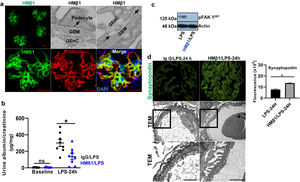 Podocyte β1 integrin is an upstream mediator of FAK activation and podocyte injury in vivo. (a) HMβ1 (green) bound glomerular but not tubular cells by immunofluorescence of mouse kidney (upper row, left side). Images captured at 20×. Scale bars: 100μm. By TEM, injected HMβ1 conjugated with 10-nm gold particles (arrowheads) deposited onto glomerular endothelial cells and to the basal aspect of podocytes (upper row). Original images captured at 20,000×. N=1. HMβ1 bound podocytes as shown by double immunostaining using podocin as podocyte marker (lower row). (b) Pre-treatment with the β1 integrin inhibitor HMβ1 ameliorated LPS-induced albuminuria. N=8 per group. *p=0.01. (c) HMβ1 prevented FAK phosphorylation in glomerular lysate following LPS. N=3–5 per group. This blot was cropped from the same gel displayed in Fig. 2b. (d) HMβ1 preserved synaptopodin expression (*p=0.02) and podocyte foot processes morphology, by transmission electron microscopy, in mice pre-treated with HMβ1 compared to Ig G controls, following LPS. N=3–5 per group. Bottom lane shows a magnification of the area marked with a black square in the middle lane. Image captured at 60×. Scale bars: 500μm.
