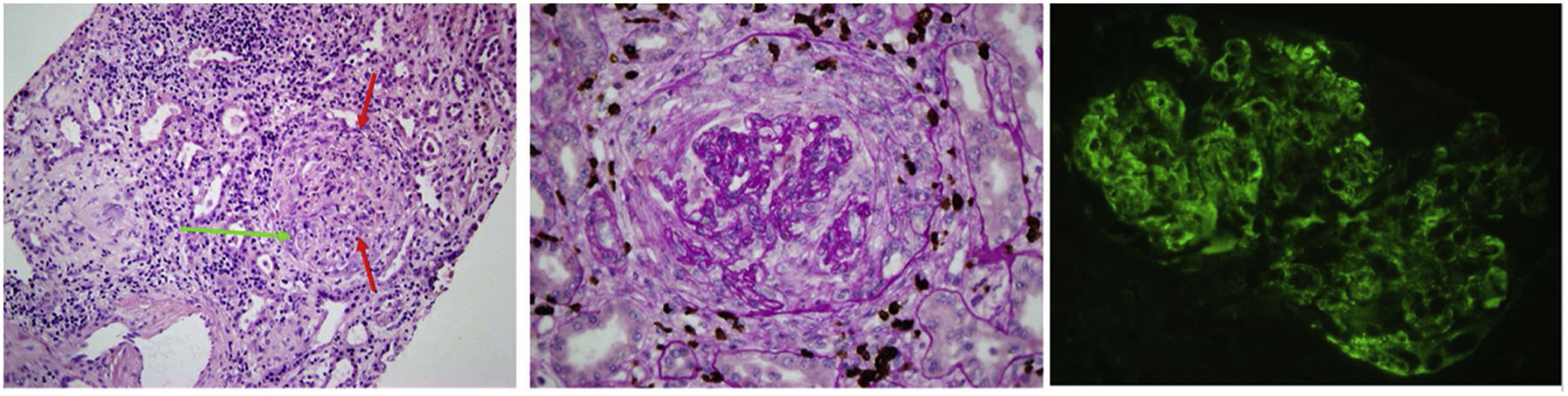 A renal failure related to the feline world | Nefrología - Reptile Renal Failure